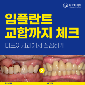 호평동치과